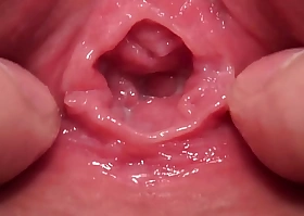 vaginal