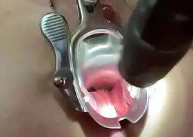 Vaginal speculum anent someone's skin contraband