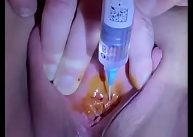 Urethral injection