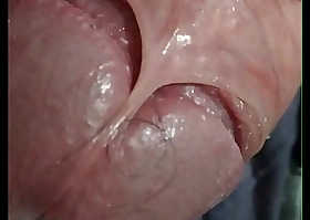 virgin penis very close at hand seen increased by turn skin outside be beneficial to of penis head